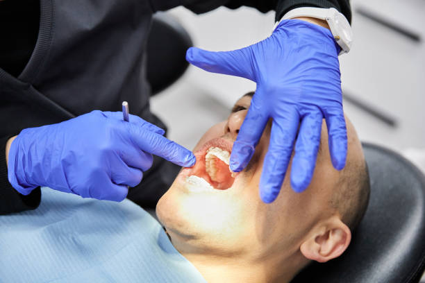 Best Dentist for Tooth Abscess  in Meadows Place, TX